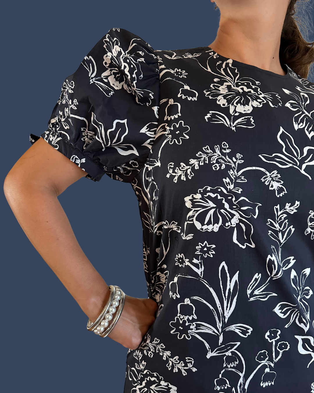 Scallop Hem Mini Dress | Black